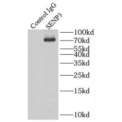 SUMO1/Sentrin/SMT3 Specific Peptidase 3 (SENP3) Antibody