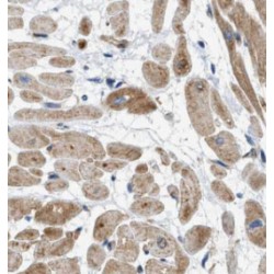 Selenoprotein N (SEPN1) Antibody