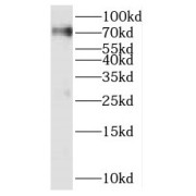 WB analysis of mouse brain tissue, using SERAC1 antibody (1/1000 dilution).