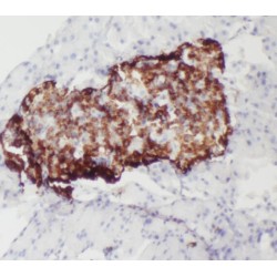 Heterochromatin-Associated Protein MENT (SERPINB10) Antibody