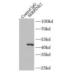 Glia Derived Nexin / GDN (SERPINE2) Antibody