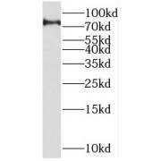 WB analysis of HL-60 cells, using SETMAR antibody (1/600 dilution).