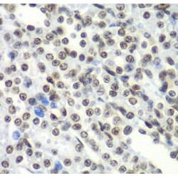 Splicing Factor 3B Subunit 2 (SF3B2) Antibody