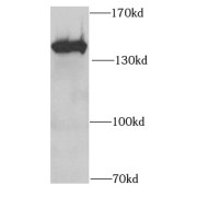 WB analysis of HEK-293 cells, using SF3B2 antibody (1/1000 dilution).