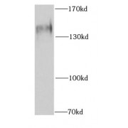 WB analysis of HeLa cells, using SF3B3 antibody (1/1000 dilution).