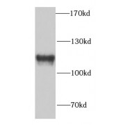 WB analysis of HeLa cells, using SFPQ antibody (1/1000 dilution).