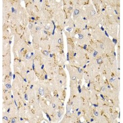 Secreted Frizzled Related Protein 2 (SFRP2) Antibody