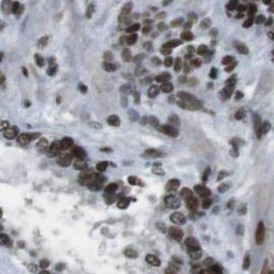 Splicing Factor, Arginine/serine-Rich 7 (SFRS7) Antibody