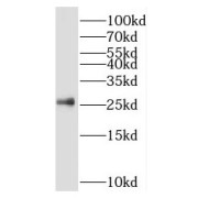 WB analysis of HEK-293 cells, using SFRS9 antibody (1/1000 dilution).