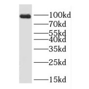 WB analysis of PC-3 cells, using SGEF antibody (1/300 dilution).