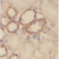 Sodium/Glucose Cotransporter 2 (SGLT2) Antibody