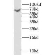 WB analysis of PC-3 cells, using SGOL1 antibody (1/400 dilution).