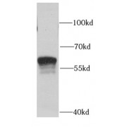 WB analysis of HEK-293 cells, using SGSH antibody (1/1000 dilution).