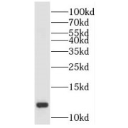 WB analysis of human placenta tissue, using SH3BGRL2 antibody (1/1000 dilution).
