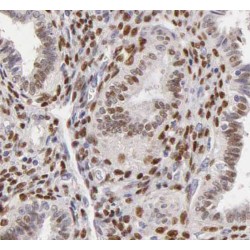 SH3 Domain-Binding Protein 5 (SH3BP5) Antibody