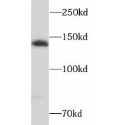 WB analysis of HeLa cells, using SH3PXD2A antibody (1/500 dilution).