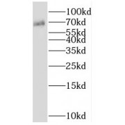 WB analysis of NIH/3T3 cells, using SHC1 antibody (1/500 dilution).
