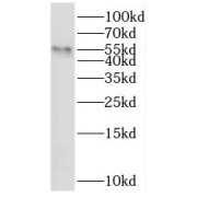 WB analysis of mouse testis tissue, using SHE antibody (1/300 dilution).