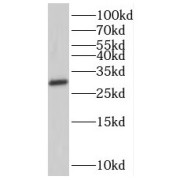 WB analysis of mouse brain tissue, using SHOX antibody (1/1000 dilution).