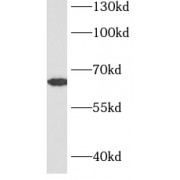 WB analysis of MCF7 cells, using SHP1 antibody (1/1000 dilution).
