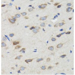 E3 Ubiquitin-Protein Ligase SIAH1 (SIAH1) Antibody