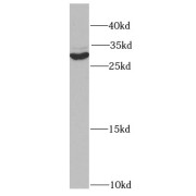 WB analysis of HeLa cells, using SIAH1 antibody (1/1000 dilution).
