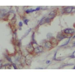 NAD-Dependent Protein Deacetylase Sirtuin-2 (SIRT2) Antibody