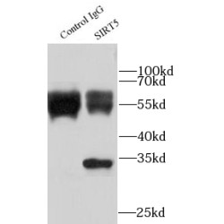 NAD-Dependent Protein Deacylase Sirtuin-5, Mitochondrial (SIRT5) Antibody