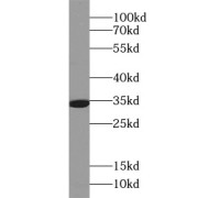 WB analysis of HeLa cells, using SIRT5 antibody (1/600 dilution).