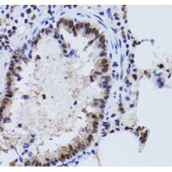 Sirtuin 7 (SIRT7) Antibody