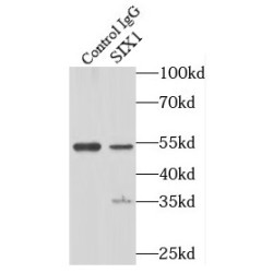 SIX Homeobox 1 (SIX1) Antibody
