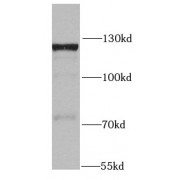 WB analysis of HeLa cells, using SKIV2L2 antibody (1/1000 dilution).
