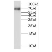 WB analysis of COLO 320 cells, using SLC11A2 antibody (1/300 dilution).