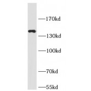 WB analysis of A549 cells, using SLC12A2 antibody (1/400 dilution).
