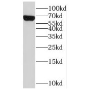 WB analysis of mouse kidney tissue, using SLC22A2 antibody (1/300 dilution).