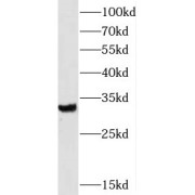 WB analysis of mouse liver tissue, using SLC25A18 antibody (1/600 dilution).