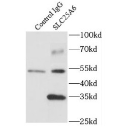 SLC25A6-Specific Antibody