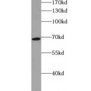 WB analysis of HepG2 cells, using SLC27A2 antibody (1/1000 dilution).