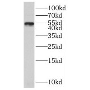 WB analysis of A375 cells, using SLC30A6 antibody (1/500 dilution).