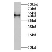WB analysis of A549 cells, using SLC35F2 antibody (1/600 dilution).