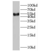 WB analysis of A549 cells, using SLC36A4 antibody (1/1000 dilution).