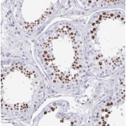 IHC-P analysis of human testis tissue, using SLC52A3 antibody (1/50 dilution).