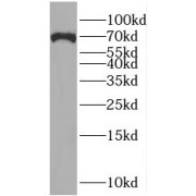WB analysis of rat kidney tissue, using SLC5A8 antibody (1/1000 dilution).