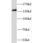 WB analysis of mouse liver tissue, using SLC9A11 antibody (1/500 dilution).