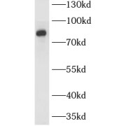 WB analysis of mouse kidney tissue, using SLCO4C1 antibody (1/600 dilution).