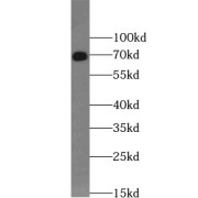 WB analysis of Jurkat cells, using LCP2 antibody (1/1000 dilution).