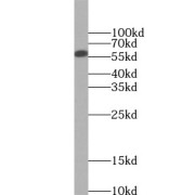 WB analysis of HeLa cells, using SMAD2 antibody (1/1000 dilution).