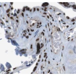 Mothers Against Decapentaplegic Homolog 4 (SMAD4) Antibody