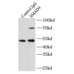 Mothers Against Decapentaplegic Homolog 4 (SMAD4) Antibody