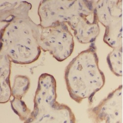 Mothers Against Decapentaplegic Homolog 4 (SMAD4) Antibody
